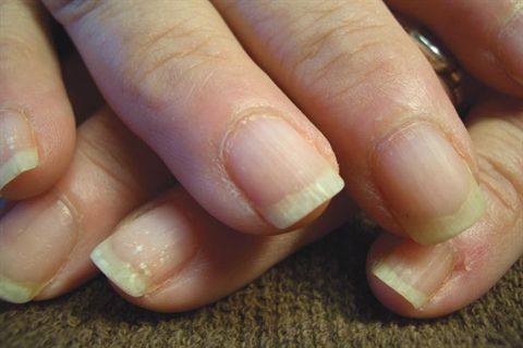 Nail Free Edge