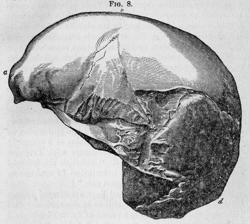 Connected By Frontal Suture