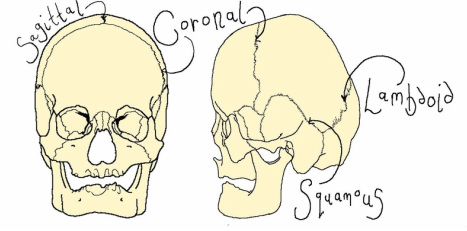 Prominent Frontal Suture